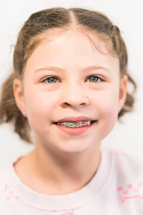 What to Expect During Your Child’s Orthodontic Visit