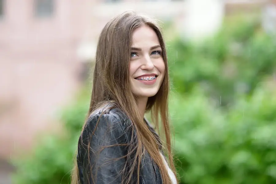 Braces 101: Everything You Need to Know About Straightening Your Teeth