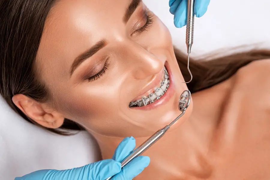 Factors That Determine How Long You’ll Need Braces For