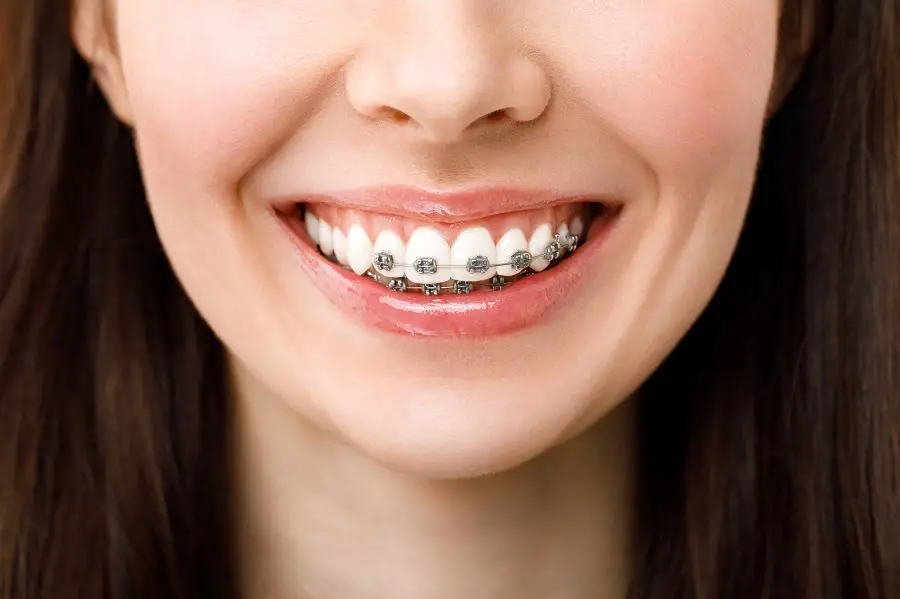 How Does Orthodontics Work?