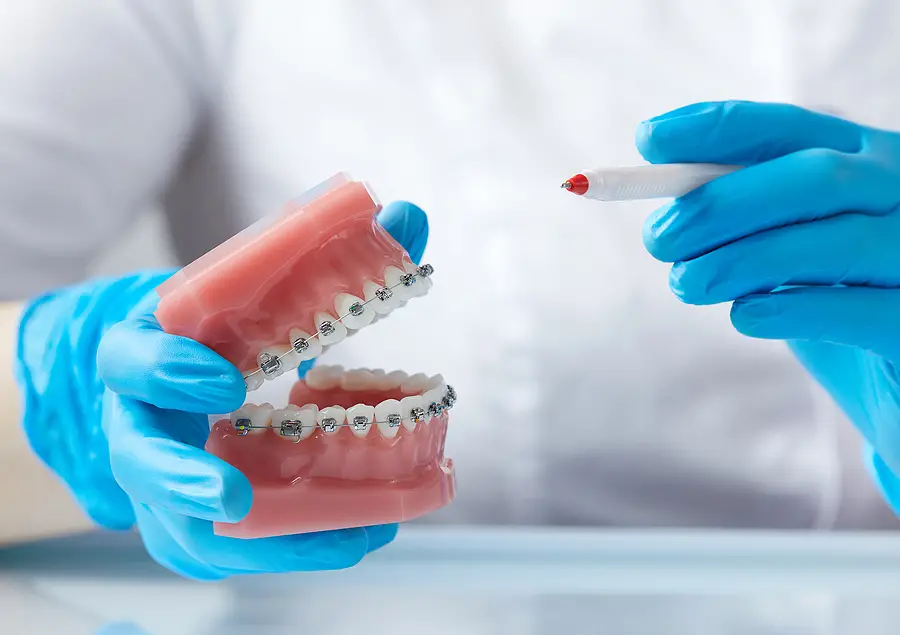Orthodontics Treatments For Adults – The Change of a Lifetime