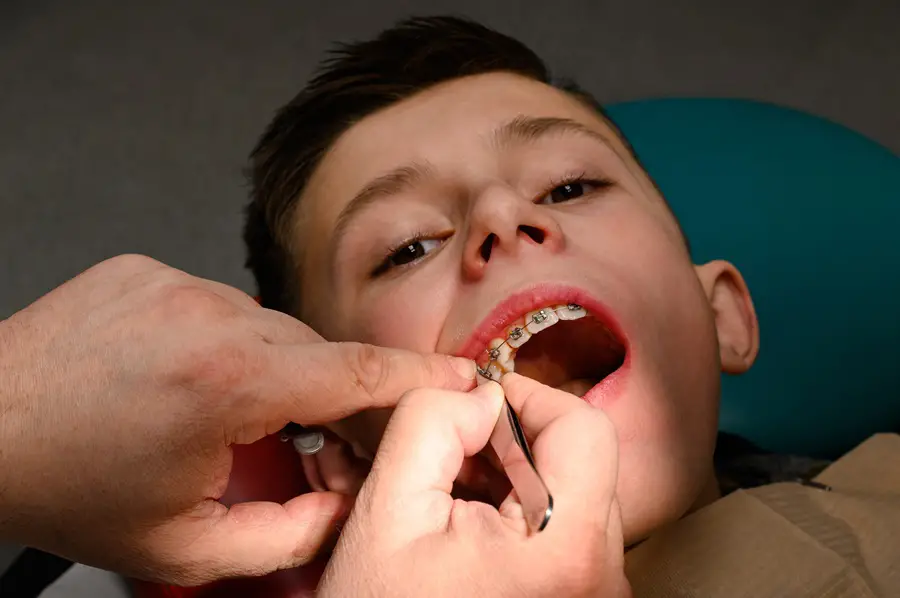 Why Early Orthodontic Treatment Is Crucial