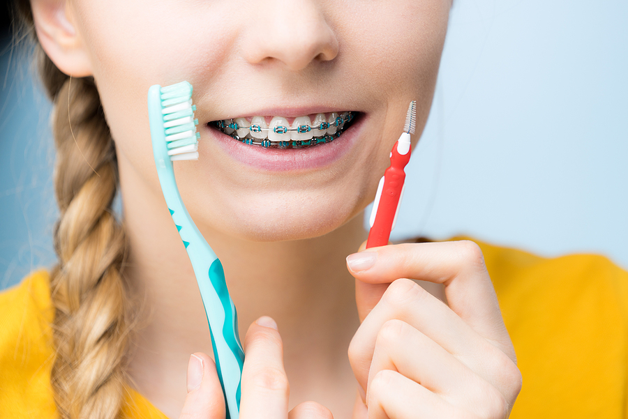 The Role of Dental Hygiene During Orthodontic Treatment – Don’t Skip It!